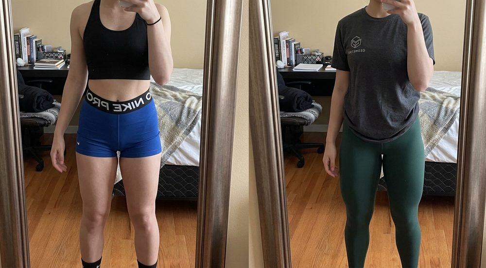 Stephanie Buttrey’s legs before and after, side by side.